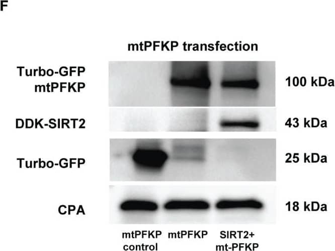 Effect of K394R mutation on PFKP. (A, B) HEK293T cells transfected with wtPFKP/mtPFKP in the presence or absence of SIRT2. Western blot analysis of Turbo-GFP-wtPFKP, DDK-SIRT2, turbo-GFP (control for wtPFKP plasmid transfected) and CPA. (C) mtPFKP transfection and IP using turbo-GFP-trap in HEK293T cells, in presence or absence of SIRT2 followed by IB analysis of acetyl lysine, turbo-GFP-mtPFKP and turbo-GFP (control for wtPFKP plasmid transfected). Pulldown with HEK293T cell lysate without transfection was used as a negative control. (D) Western blot analysis of turbo-GFP mtPFKP, DDK-SIRT2, turbo-GFP and CPA in whole cell lysate, used as an input for the turbo-GFP IP. (E) mtPFKP transfection and IP using magnetic-TUBEs in HEK293T cells, in presence or absence of SIRT2 followed by IB analysis of ubiquitination. (F) Western blot analysis of turbo-GFP mtPFKP, DDK-SIRT2, turbo-GFP and CPA in whole cell lysate used as input for the TUBE IP. Image collected and cropped by CiteAb from the following open publication (//pubmed.ncbi.nlm.nih.gov/36865524), licensed under a CC-BY license. Not internally tested by Novus Biologicals.