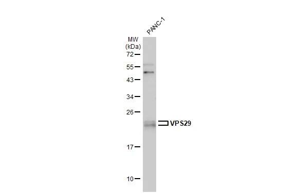 Western Blot: VPS29 Antibody [NBP1-30994] - Whole cell extract (30 ug) was separated by 12% SDS-PAGE, and the membrane was blotted with VPS29 antibody [C1C3] (NBP1-30994) diluted at 1:1500. The HRP-conjugated anti-rabbit IgG antibody  was used to detect the primary antibody, and the signal was developed with Trident ECL plus-Enhanced.