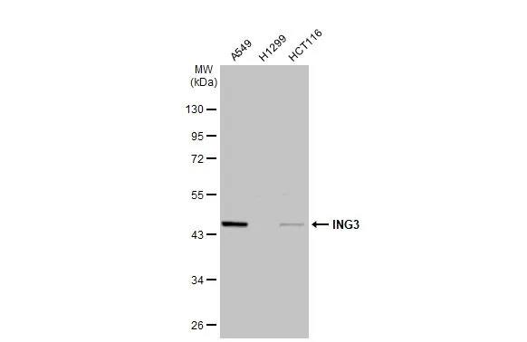 Western Blot: ING3 Antibody [NBP1-30996] - Various whole cell extracts (30 ug) were separated by 10% SDS-PAGE, and the membrane was blotted with ING3 antibody [N2N3] (NBP1-30996) diluted at 1:1000. The HRP-conjugated anti-rabbit IgG antibody  was used to detect the primary antibody.