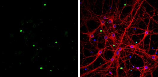 Olig1 antibody [C2C3], C-term detects Olig1 protein by immunofluorescent analysis.Sample: DIV9 rat E18 primary cortical neurons and glia cells were fixed in 4% paraformaldehyde at RT for 15 min.Green: Olig1 protein stained by Olig1 antibody [C2C3], C-term (NBP1-31018) diluted at 1:500.Red: beta Tubulin 3/ Tuj1, stained by beta Tubulin 3/ Tuj1 antibody [GT886] diluted at 1:500.Blue: Fluoroshield with DAPI . 
