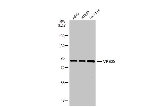 Western Blot: VPS35 Antibody [NBP1-31069] - Various whole cell extracts (30 ug) were separated by 7.5% SDS-PAGE, and the membrane was blotted with VPS35 antibody [C3], C-term (NBP1-31069) diluted at 1:1000. The HRP-conjugated anti-rabbit IgG antibody  was used to detect the primary antibody.