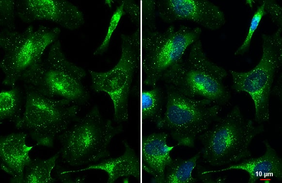 Immunocytochemistry/ Immunofluorescence: VPS35 Antibody [NBP1-31069] - VPS35 antibody [C3], C-term detects VPS35 protein at endosome by immunofluorescent analysis.Sample: HeLa cells were fixed in 4% paraformaldehyde at RT for 15 min.Green: VPS35 stained by VPS35 antibody [C3], C-term (NBP1-31069) diluted at 1:500.Blue: Fluoroshield with DAPI .