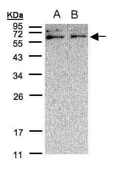 Sample(30 ug of whole cell lysate)A:A431B:H129912% SDS PAGENBP1-31095 diluted at 1:500 