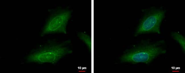 karyopherin alpha 2 antibody [C3], C-term detects karyopherin alpha 2 protein at cytoplasm and nucleus by immunofluorescent analysis.Sample: HeLa cells were fixed in ice-cold MeOH for 5 min.Green: karyopherin alpha 2 protein stained by karyopherin alpha 2 antibody [C3], C-term (NBP1-31098) diluted at 1:500.Blue: Hoechst 33342 staining.Scale bar = 10 um. 