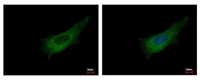 Pleckstrin antibody [C2C3], C-term detects PLEK protein at cytoplasm by immunofluorescent analysis. Sample: HeLa cells were fixed in -20? 100% MeOH for 5 min.Green: PLEK protein stained by Pleckstrin antibody [C2C3], C-term (NBP1-31099) diluted at 1:500.Blue: Hoechst 33343 staining. 