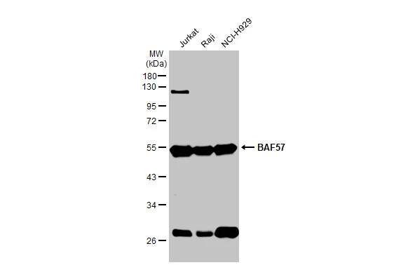 Western Blot: BAF57 Antibody [NBP1-31100] - Various whole cell extracts (30 ug) were separated by 10% SDS-PAGE, and the membrane was blotted with BAF57 antibody [C3], C-term (NBP1-31100) diluted at 1:3000. The HRP-conjugated anti-rabbit IgG antibody  was used to detect the primary antibody.