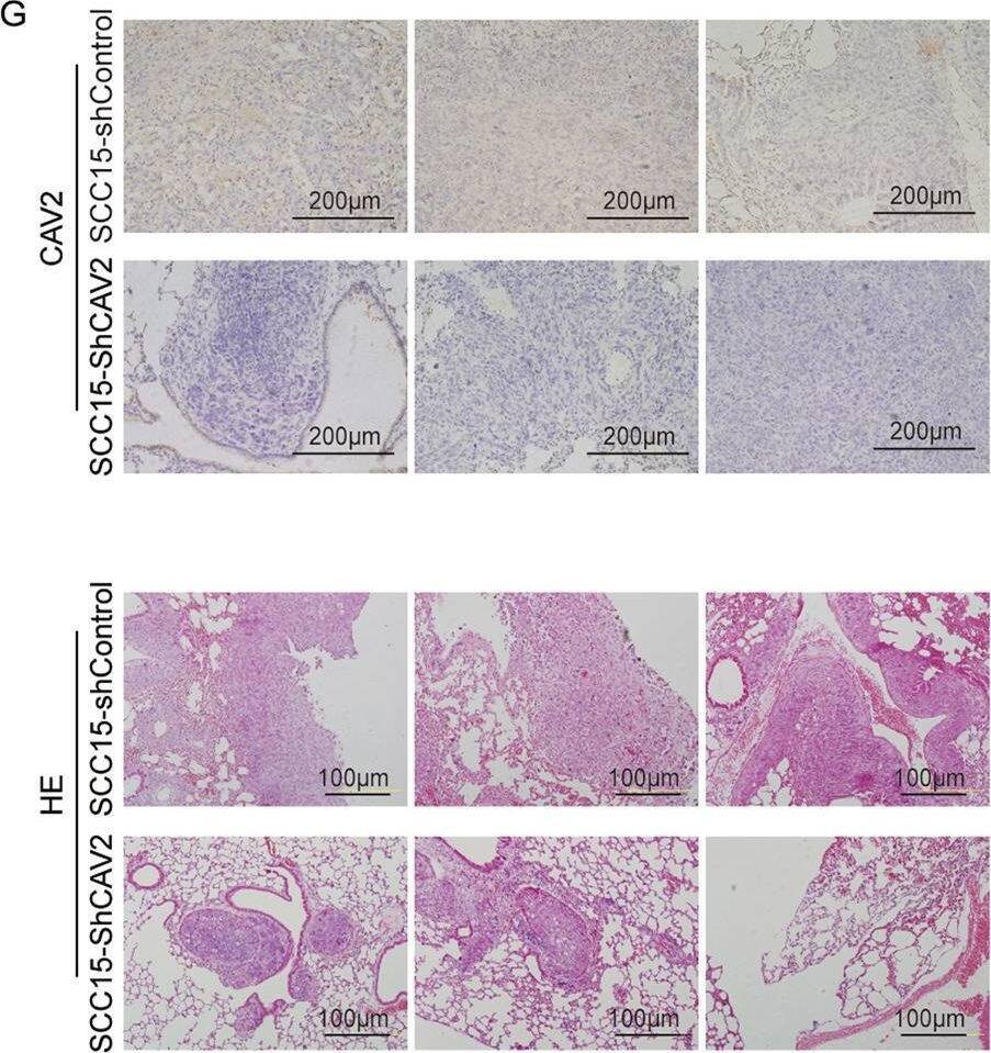 CAV2 promotes HNSCC metastasis both in vitro and in vivo.Silencing CAV2 in SCC15 and SCC25 cells by transfection with two individual CAV2 shRNAs significantly decreased CAV2 expression, as detected by western blotting (A) and QT-PCR (B). C, D The silencing of CAV2 significantly inhibited the migration and invasion of SCC15 and SCC25 cells, as evaluated using Transwell assays. (Scale bar, 200 μm). E Images of the macroscopic lung tissues of tail vein-injected mice. F The lung metastasis nodules were counted, and the data from the shCAV2 and negative control groups are summarized. ‘****’ indicates ‘p < 0.0001’. G CAV2 IHC staining and H&E staining to assess lung metastasis in tail vein-injected mice. (Scale bars, 200 μm and 100 μm). Image collected and cropped by CiteAb from the following open publication (//pubmed.ncbi.nlm.nih.gov/36114176), licensed under a CC-BY license. Not internally tested by Novus Biologicals.