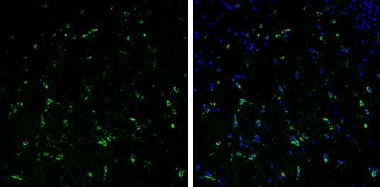 Immunohistochemistry-Frozen Stathmin 1 Antibody - BSA Free