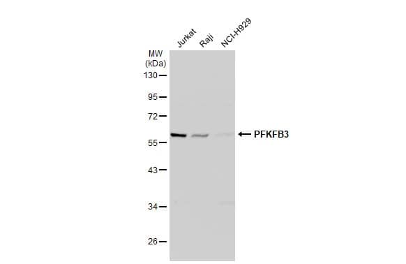 Western Blot: 6 Phosphofructo 2 Kinase Antibody [NBP1-31147] - Various whole cell extracts (30 ug) were separated by 10% SDS-PAGE, and the membrane was blotted with 6 Phosphofructo 2 Kinase antibody [C3], C-term (NBP1-31147) diluted at 1:1000. The HRP-conjugated anti-rabbit IgG antibody  was used to detect the primary antibody.