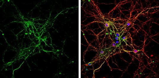 BMP-9 antibody [C3], C-term detects BMP-9 protein by immunofluorescent analysis.Sample: DIV10 rat E18 primary hippocampal neurons were fixed in 4% paraformaldehyde at RT for 15 min.Green: BMP-9 protein stained by BMP-9 antibody [C3], C-term (NBP1-31151) diluted at 1:500.Red: beta Tubulin 3/ Tuj1, stained by beta Tubulin 3/ Tuj1 antibody [GT1338] diluted at 1:500.Blue: Fluoroshield with DAPI . 