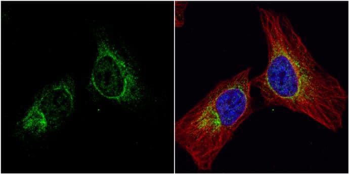 IFIT2 antibody [N1], N-term detects IFIT2 protein at endoplasmic reticulum by immunofluorescent analysis.Sample: HeLa cells were fixed in 4% paraformaldehyde at RT for 15 min.Green: IFIT2 protein stained by IFIT2 antibody [N1], N-term (NBP1-31164) diluted at 1:200.Red: alpha Tubulin, a cytoskeleton marker, stained by alpha Tubulin antibody [B-5-1-2] diluted at 1:10000.Blue: Hoechst 33342 staining. 