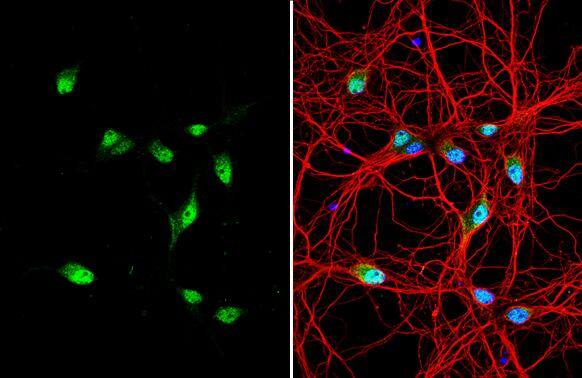 Centaurin alpha 1 antibody [C3], C-term detects Centaurin alpha 1 protein by immunofluorescent analysis.Sample: DIV9 rat E18 primary hippocampal neuron cells were fixed in 4% paraformaldehyde at RT for 15 min.Green: Centaurin alpha 1 stained by Centaurin alpha 1 antibody [C3], C-term (NBP1-31179) diluted at 1:500.Red: beta Tubulin 3/ Tuj1, stained by beta Tubulin 3/ Tuj1 antibody [GT11710] diluted at 1:500.Blue: Fluoroshield with DAPI . 
