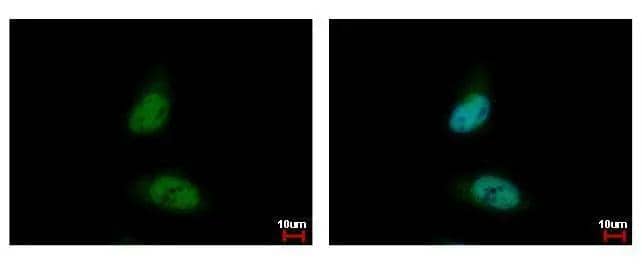 HDAC3 antibody [C3], C-term detects HDAC3 protein at nucleus by immunofluorescent analysis. Sample: HeLa cells were fixed in 4% paraformaldehyde at RT for 15 min.Green: HDAC3 protein stained by HDAC3 antibody [C3], C-term (NBP1-31196) diluted at 1:500.Blue: Hoechst 33342 staining. 