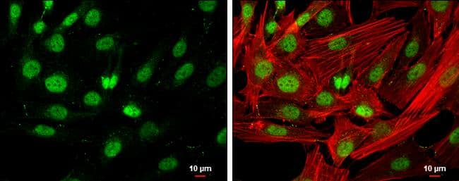 HDAC3 antibody [C3], C-term detects HDAC3 protein at nucleus by immunofluorescent analysis.Sample: SK-N-SH cells were fixed in 4% paraformaldehyde at RT for 15 min.Green: HDAC3 protein stained by HDAC3 antibody [C3], C-term (NBP1-31196) diluted at 1:400.Red: Phalloidin, a cytoskeleton marker, diluted at 1:200.Scale bar = 10 um. 