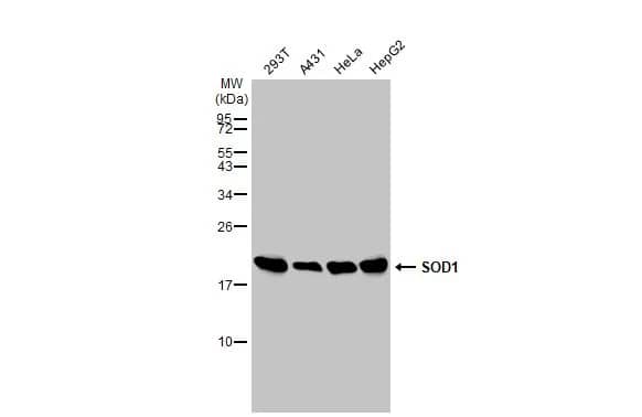 Western Blot: SOD1/Cu-Zn SOD Antibody [NBP1-31204] - Various whole cell extracts (30 ug) were separated by 15% SDS-PAGE, and the membrane was blotted with SOD1/Cu-Zn SOD antibody (NBP1-31204) diluted at 1:1000. The HRP-conjugated anti-rabbit IgG antibody  was used to detect the primary antibody.