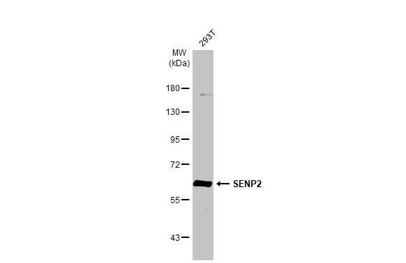 Western Blot: SENP2 Antibody [NBP1-31217] - Whole cell extract (30 ug) was separated by 7.5% SDS-PAGE, and the membrane was blotted with SENP2 antibody [N1], N-term (NBP1-31217) diluted at 1:500. The HRP-conjugated anti-rabbit IgG antibody  was used to detect the primary antibody.