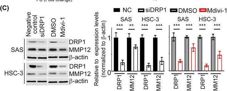 MMP12 is one of the targets of DRP1 in HNC cells. (A) Heat‐map showing relative alteration of target genes belonging to EMT molecules using QPCR array analysis of SAS cell transfected with siDRP1 compared with the negative control. Red: upregulation; green: downregulation. (B) QPCR was analyzed to validate the expressions of target genes from (A). (C) Impact of DRP1 knockdown or Mdivi‐1 on MMP12 protein expression were demonstrated in SAS and HSC‐3 cells. Quantification of relative DRP1 and MMP12 expressions are shown. (D,E) Cell growth and motility were evaluated in DRP1‐depleted cells transfected with MMP12 using MTT and Transwell assays. Quantification of relative Flag‐MMP12 expression is shown. (F) Studies from GEPIA and Oncomine datasets present the increase of MMP12 mRNA in HNC samples. (G) A positive correlation between DRP1 mRNA and MMP12 mRNA was found in the Oncomine cohort (Peng database, n = 41; Estilo database, n = 31). All data are presented as mean  +/-  SD of three independent experiments. Significance was calculated using t‐test. In (D) (cell growth) and (F) (GEPIA), statistical analyses were performed using one‐way ANOVA followed by Tukey’s multiple comparison’s test and Wilcoxon signed‐rank test, respectively. * P < 0.05, ** P < 0.01, *** P < 0.001. Image collected and cropped by CiteAb from the following open publication (//pubmed.ncbi.nlm.nih.gov/35313071), licensed under a CC-BY license. Not internally tested by Novus Biologicals.