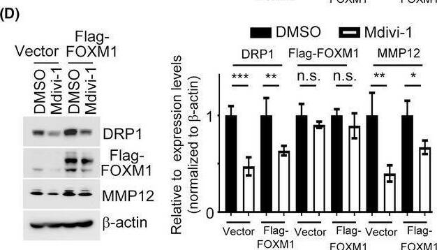 MMP12 expression is essential for DRP1/FOXM1 regulation in HNC cells. (A) The mRNA and protein expression levels of FOXM1 in siDRP1 cells were examined. Quantification of relative FOXM1 expression is shown. (B,C) Western blotting, QPCR and luciferase activity analysis of MMP12 were determined in SAS cells transfected with FOXM1 or vector control in combination with siDRP1 or negative control. Quantification of relative DRP1, Flag‐FOXM1 and MMP12 expressions is shown. (D,E) Western blotting, QPCR and luciferase activity of MMP12 were analyzed in SAS cells transfected with FOXM1 or vector control in combination with Mdivi‐1 treatment. Quantification of relative DRP1, Flag‐FOXM1, and MMP12 expressions is shown. (F) IHC staining patterns of the HNC tumor tissues for DRP1, FOXM1 and MMP12. Scale bar: 100 um. All data presented as mean  +/-  SD of three independent experiments. Significance calculated using t‐test. * P < 0.05, ** P < 0.01, *** P < 0.001. Image collected and cropped by CiteAb from the following open publication (//pubmed.ncbi.nlm.nih.gov/35313071), licensed under a CC-BY license. Not internally tested by Novus Biologicals.