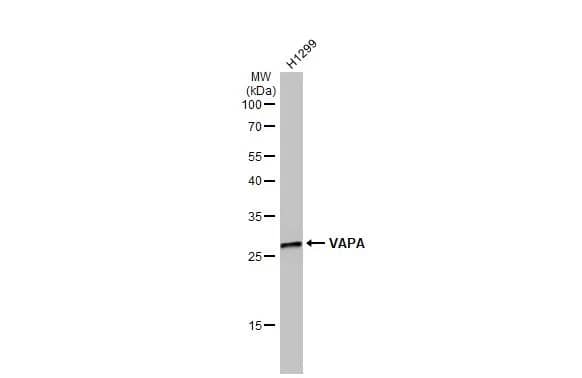 Western Blot: VAP-A Antibody [NBP1-31237] - Whole cell extract (30 ug) was separated by 12% SDS-PAGE, and the membrane was blotted with VAP-A antibody [N1N3] (NBP1-31237) diluted at 1:1000. The HRP-conjugated anti-rabbit IgG antibody  was used to detect the primary antibody.