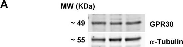 Western Blot: GPER/GPR30 Antibody [NBP1-31239] - Human endothelial cells express GPR30 protein in the cell nucleus.(A) Confluent monolayers of HUVECs from 3 different cords were lysed & the protein lysates were immunoblotted for GPR30.  alpha -tubulin was used as loading control. (B) HUVEC monolayers at 30–40% confluence were treated with 40 nM siRNA (control or GPR30_4) for 48 hours prior to lysis followed by immunoblotting of the cell lysates for GPR30.  alpha -tubulin was used as loading control. Data shown are mean ± SEM of 4 independent experiments. ** & ## indicate p<0.01 compared to untreated & control siRNA-treated cells, respectively. (C) Confluent HUVECs grown on glass coverslips were fixed, permeabilized & immunostained with anti-GPR30 antibody. Nuclei were stained with Hoechst33342 dye. The merged image shows GPR30 (red) & nuclei (blue) in pseudocolor. Representative images from 3 independent experiments are shown. Bar, 20 µm. (D) Confluent HUVECs were lysed & fractionated into cytosolic (C) & nuclear (N) fractions prior to western blotting for eNOS, GPR30, p65,  alpha -tubulin & c-Jun. A representative set of images (obtained from different membranes) from 3 independent experiments is shown. Image collected & cropped by CiteAb from the following publication (//pubmed.ncbi.nlm.nih.gov/23285008), licensed under a CC-BY license. Not internally tested by Novus Biologicals.