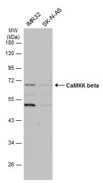 Western Blot: CaMKK2 Antibody [NBP1-31247] - Various whole cell extracts (30 ug) were separated by 10% SDS-PAGE, and the membrane was blotted with CaMKK2 antibody (NBP1-31247) diluted at 1:1000. The HRP-conjugated anti-rabbit IgG antibody  was used to detect the primary antibody.