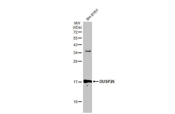 Western Blot: DUSP26 Antibody [NBP1-31254] - Whole cell extract (30 ug) was separated by 12% SDS-PAGE, and the membrane was blotted with DUSP26 antibody [N1C1] (NBP1-31254) diluted at 1:500. The HRP-conjugated anti-rabbit IgG antibody  was used to detect the primary antibody.