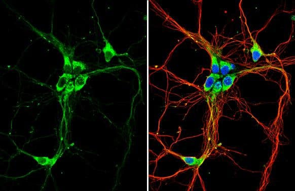 GPER/GPR30 antibody detects GPER/GPR30 protein by immunofluorescent analysis.Sample: DIV9 rat E18 primary hippocampal neuron cells were fixed in 4% paraformaldehyde at RT for 15 min.Green: GPER/GPR30 stained by GPER/GPR30 antibody (NBP1-31258) diluted at 1:500.Red: beta Tubulin 3/ Tuj1, stained by beta Tubulin 3/ Tuj1 antibody [GT11710] diluted at 1:500.Blue: Fluoroshield with DAPI . 