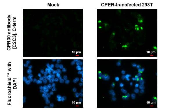 GPER/GPR30 antibody [C2C3], C-term detects GPER/GPR30 protein by immunofluorescent analysis.Sample: Mock and transfected 293T cells were fixed in ice-cold MeOH for 5 min.Green: GPER/GPR30 stained by GPER/GPR30 antibody [C2C3], C-term (NBP1-31258) diluted at 1:500.Blue: Fluoroshield with DAPI . 