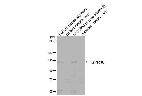 <b>Orthogonal Strategies Validation. </b>Boiled and unboiled various tissue extracts (50 ug) were separated by 7.5% SDS-PAGE, and the membrane was blotted with GPER/GPR30 antibody [C2C3], C-term (NBP1-31258) diluted at 1:1000. The HRP-conjugated anti-rabbit IgG antibody was used to detect the primary antibody, and the signal was developed with Trident ECL plus-Enhanced. 