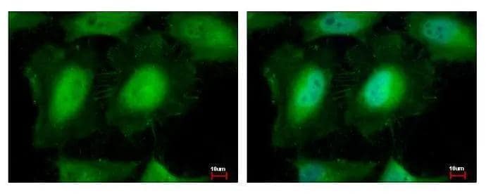 eIF3K antibody [N1C2] detects eIF3K protein at cytoplasm and nucleus by immunofluorescent analysis. Sample: HeLa cells were fixed in 4% paraformaldehyde at RT for 15 min.Green: eIF3K protein stained by eIF3K antibody [N1C2] (NBP1-31285) diluted at 1:500.Blue: Hoechst 33343 staining. 