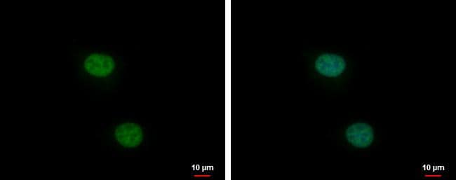 XLF antibody [N3C3] detects XLF protein at nucleus by immunofluorescent analysis.Sample: HeLa cells were fixed in 4% paraformaldehyde at RT for 15 min.Green: XLF protein stained by XLF antibody [N3C3] (NBP1-31288) diluted at 1:1000.Blue: Hoechst 33342 staining. 