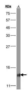 Western Blot: COX5b Antibody [NBP1-31303] - Sample(30 ug of whole cell lysate)A:Hep G215% SDS PAGENBP1-31303 diluted at 1:1000