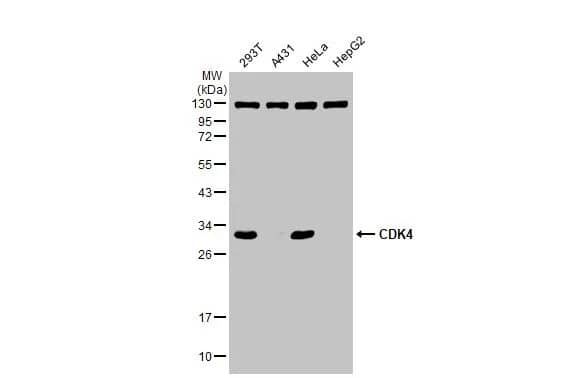 Western Blot: CDK4 Antibody [NBP1-31308] - Various whole cell extracts (30 ug) were separated by 12% SDS-PAGE, and the membrane was blotted with CDK4 antibody (NBP1-31308) diluted at 1:1000. The HRP-conjugated anti-rabbit IgG antibody  was used to detect the primary antibody.