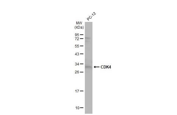 Western Blot: CDK4 Antibody [NBP1-31308] - Whole cell extract (30 ug) was separated by 12% SDS-PAGE, and the membrane was blotted with CDK4 antibody (NBP1-31308) diluted at 1:500. The HRP-conjugated anti-rabbit IgG antibody  was used to detect the primary antibody.