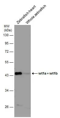 Western Blot: WT1 Antibody [NBP1-31314] - Various tissue extracts (30 ug) were separated by 10% SDS-PAGE, and the membrane was blotted with wt1a + wt1b antibody (NBP1-31314) diluted at 1:1000.