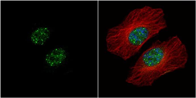 Immunocytochemistry/ Immunofluorescence HMBOX1 Antibody - BSA Free