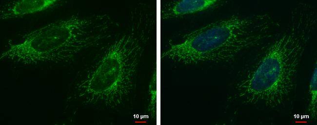 FASTK antibody detects FASTK protein at mitochondria by immunofluorescent analysis.Sample: HeLa cells were fixed in ice-cold MeOH for 5 min.Green: FASTK protein stained by FASTK antibody (NBP1-31323) diluted at 1:1000.Blue: Hoechst 33342 staining.Scale bar = 10 um. 