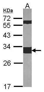 Sample (30 ug of whole cell lysate) A:NIH-3T312% SDS PAGE NBP1-31325 diluted at 1:1000 The HRP-conjugated anti-rabbit IgG antibody was used to detect the primary antibody. 