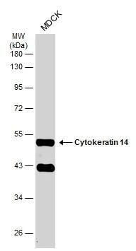 Western Blot: Cytokeratin 14 Antibody [NBP1-31326] - Whole cell extract (30 ug) was separated by 10% SDS-PAGE, and the membrane was blotted with Cytokeratin 14 antibody (NBP1-31326) diluted at 1:6000. The HRP-conjugated anti-rabbit IgG antibody  was used to detect the primary antibody.