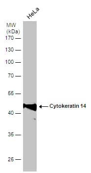 Western Blot: Cytokeratin 14 Antibody [NBP1-31326] - Whole cell extract (30 ug) was separated by 10% SDS-PAGE, and the membrane was blotted with Cytokeratin 14 antibody (NBP1-31326) diluted at 1:6000.