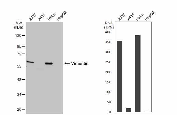 <b>Orthogonal Strategies Validation. </b>Western Blot: Vimentin Antibody [NBP1-31327] - Various whole cell extracts (30 ug) were separated by 10% SDS-PAGE, and the membrane was blotted with Vimentin antibody  diluted at 1:50000. The HRP-conjugated anti-rabbit IgG antibody  was used to detect the primary antibody. Corresponding RNA expression data for the same cell lines are based on Human Protein Atlas program.