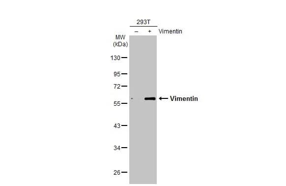 Western Blot: Vimentin Antibody [NBP1-31327] - Non-transfected (-) and transfected (+) 293T whole cell extracts (10 ug) were separated by 10% SDS-PAGE, and the membrane was blotted with Vimentin antibody (NBP1-31327) diluted at 1:10000. The HRP-conjugated anti-rabbit IgG antibody  was used to detect the primary antibody.