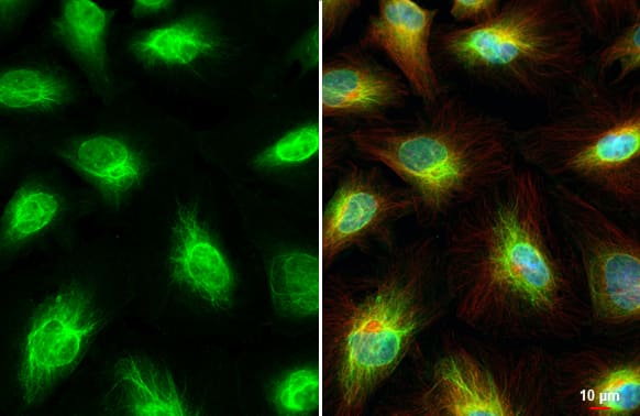 Immunocytochemistry/ Immunofluorescence: Vimentin Antibody [NBP1-31327] - Vimentin antibody detects Vimentin protein at cytoskeleton and nucleus by immunofluorescent analysis.Sample: HeLa cells were fixed in 4% paraformaldehyde at RT for 15 min.Green: Vimentin stained by Vimentin antibody (NBP1-31327) diluted at 1:500.Red: alpha Tubulin, a cytoskeleton marker, stained by alpha Tubulin antibody [GT114]  diluted at 1:1000.Blue: Fluoroshield with DAPI .