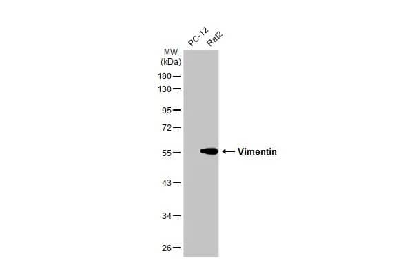 Western Blot: Vimentin Antibody [NBP1-31327] - Various whole cell extracts (30 ug) were separated by 10% SDS-PAGE, and the membrane was blotted with Vimentin antibody (NBP1-31327) diluted at 1:5000. The HRP-conjugated anti-rabbit IgG antibody  was used to detect the primary antibody.