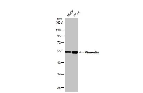 Western Blot: Vimentin Antibody [NBP1-31327] - Various whole cell extracts (30 ug) were separated by 10% SDS-PAGE, and the membrane was blotted with Vimentin antibody (NBP1-31327) diluted at 1:20000. The HRP-conjugated anti-rabbit IgG antibody  was used to detect the primary antibody.