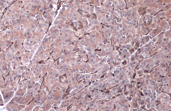 Immunohistochemistry-Paraffin: Vimentin Antibody [NBP1-31327] - Vimentin antibody detects Vimentin protein by immunohistochemical analysis.Sample: Paraffin-embedded dog pancreas.Vimentin stained by Vimentin antibody (NBP1-31327) diluted at 1:500.Antigen Retrieval: Citrate buffer, pH 6.0, 15 min