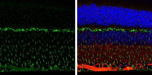 Immunohistochemistry-Paraffin: Vimentin Antibody [NBP1-31327] - Vimentin antibody detects Vimentin protein expression by immunohistochemical analysis.Sample:Paraffin-Embedded adult mouse retina. Green: Vimentin protein stained by Vimentin antibody (NBP1-31327) diluted at 1:250.Red: beta Tubulin 3/ TUJ1, stained by beta Tubulin 3/ TUJ1 antibody [GT11710]  diluted at 1:500.Blue: Fluoroshield with DAPI .