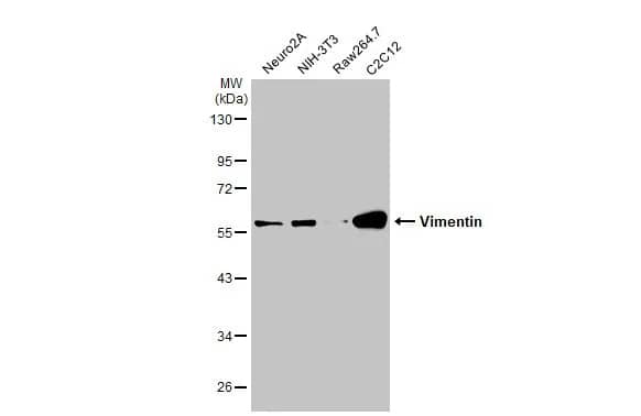 Western Blot: Vimentin Antibody [NBP1-31327] - Various whole cell extracts (30 ug) were separated by 10% SDS-PAGE, and the membrane was blotted with Vimentin antibody (NBP1-31327) diluted at 1:5000. The HRP-conjugated anti-rabbit IgG antibody  was used to detect the primary antibody.