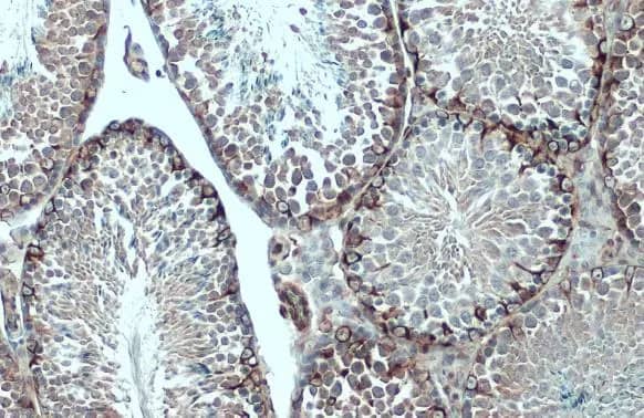 Immunohistochemistry-Paraffin: Vimentin Antibody [NBP1-31327] - Vimentin antibody detects Vimentin protein at cytoplasm by immunohistochemical analysis.Sample: Paraffin-embedded mouse testis.Vimentin stained by Vimentin antibody (NBP1-31327) diluted at 1:500.Antigen Retrieval: Citrate buffer, pH 6.0, 15