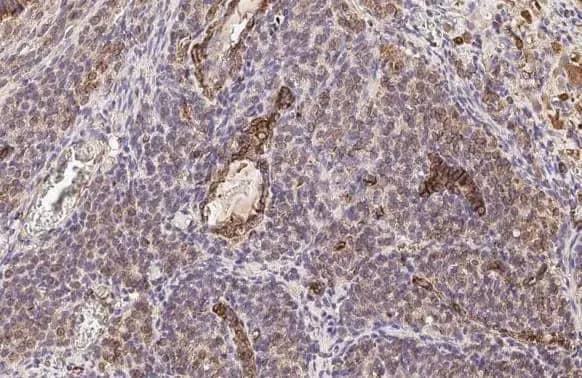 Immunohistochemistry-Paraffin: Vimentin Antibody [NBP1-31327] - Vimentin antibody detects Vimentin protein at cell membrane and cytoplasm by immunohistochemical analysis.Sample: Paraffin-embedded rat ovary.Vimentin stained by Vimentin antibody (NBP1-31327) diluted at 1:500.Antigen Retrieval: Citrate buffer, pH 6.0, 15 min